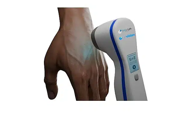 Üniversite öğrencisi babasının hastalığından yola çıkarak vitiligo tedavisi için cihaz geliştirdi