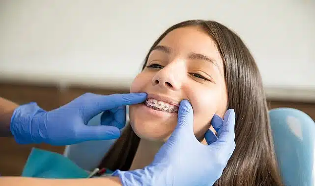 Ortodontik Tedaviler İçin ‘Ergenlik’ En İdeal Dönem
